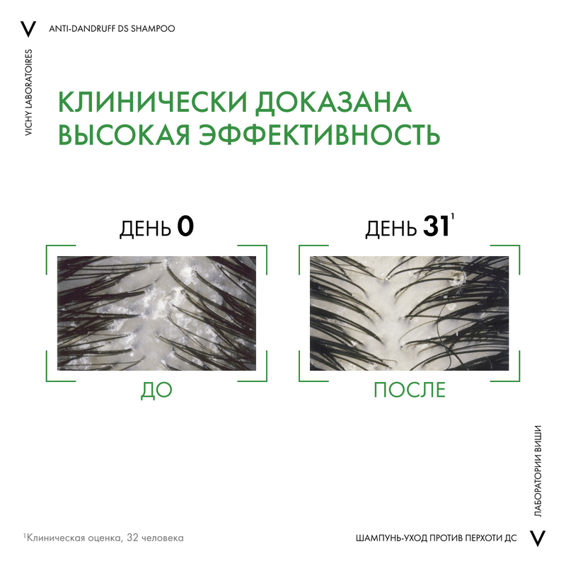 Vichy Dercos Шампунь-уход интенсивный против перхоти для нормальных и жирных волос 200 мл