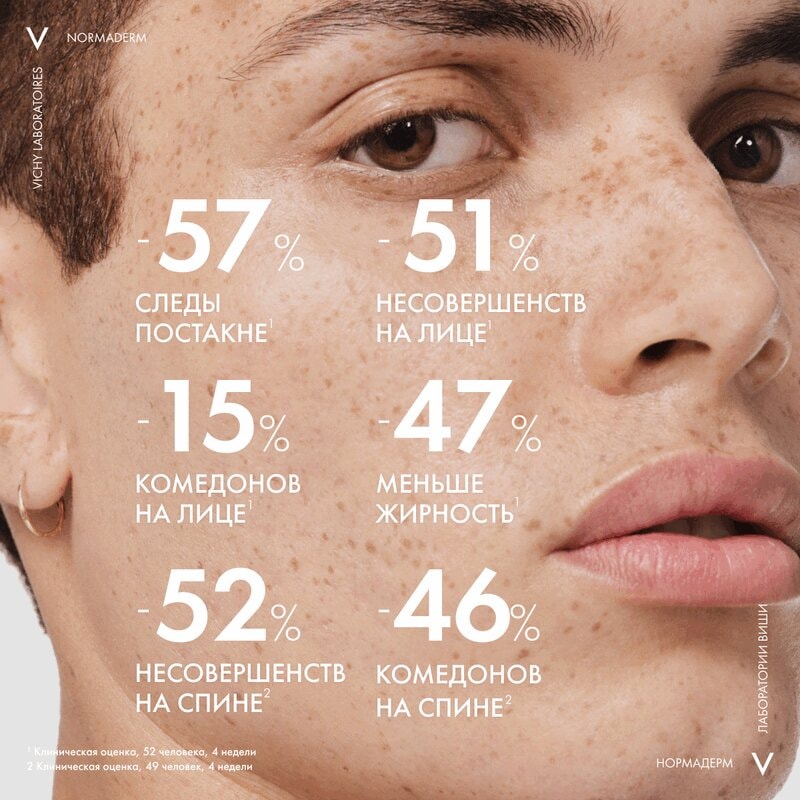 Vichy Normaderm Гель-сыворотка очищающая с эффектом пилинга 125 мл