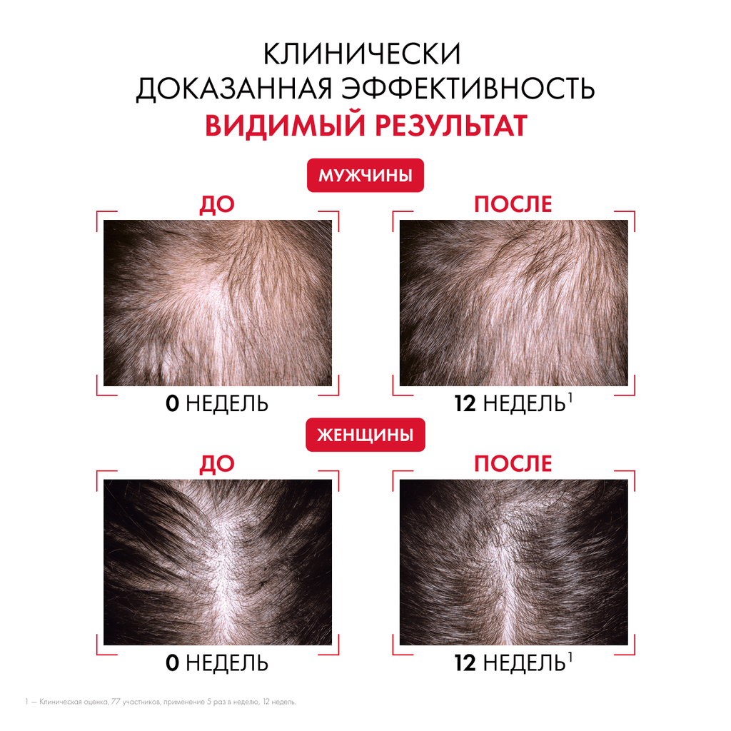 Vichy Dercos Aminexil R.E.G.E.N. Booster Сыворотка для укрепления и роста волос 90 мл