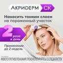 Акридерм СК 0,05%+2% раствор для наружного применения 50 мл