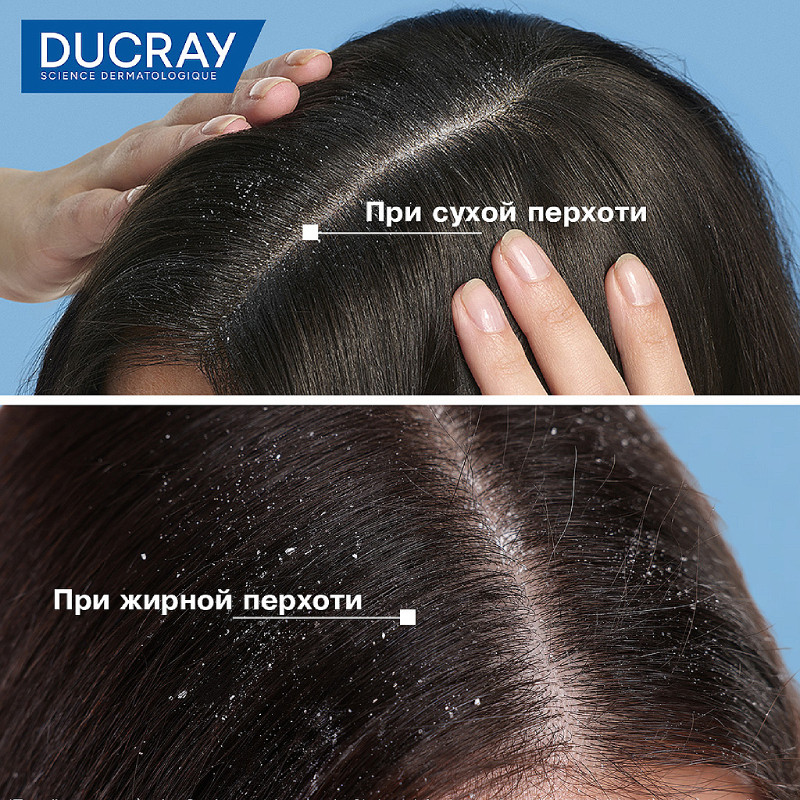 Ducray Kelual Squanorm Лосьон от перхоти 200 мл